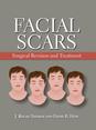 Facial Scars Surgical Revision And Treatment