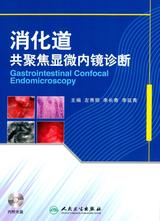 消化道共聚焦显微内镜诊断 消化道共聚焦显微内镜诊断