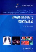 肺癌影像诊断与临床新进展