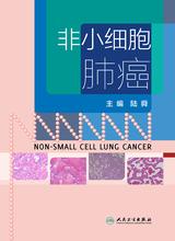 非小细胞肺癌
