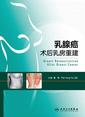 乳腺癌术后乳房重建