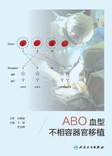 ABO血型不相容器官移植