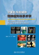 计算机导航辅助骨肿瘤外科手术学 计算机导航辅助骨肿瘤外科手术学