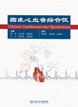 临床心血管综合征 临床心血管综合征