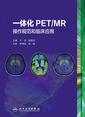 一体化PET/MR操作规范和临床应用