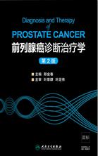 前列腺癌诊断治疗学(第2版) 前列腺癌诊断治疗学(第2版)