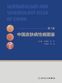 中国皮肤病性病图鉴(第3版)