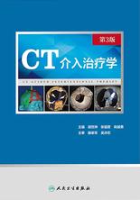 CT介入治疗学（第3版）
