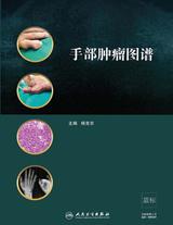 手部肿瘤图谱 手部肿瘤图谱