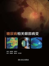 糖尿病相关眼部病变 糖尿病相关眼部病变