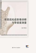 骨质疏松症影像诊断与骨密度测量 骨质疏松症影像诊断与骨密度测量