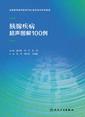 胰腺疾病超声图解100例