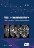 颅脑7.0T磁共振成像诊断学