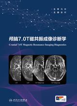 颅脑7.0T磁共振成像诊断学
