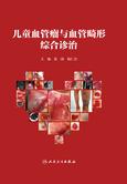 儿童血管瘤与血管畸形综合诊治
