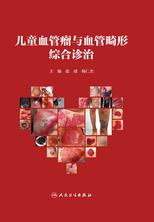 儿童血管瘤与血管畸形综合诊治 儿童血管瘤与血管畸形综合诊治