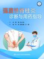 强直性脊柱炎诊断与用药指导