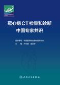 冠心病CT检查和诊断中国专家共识