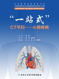 “一站式”CT平扫——心肺疾病